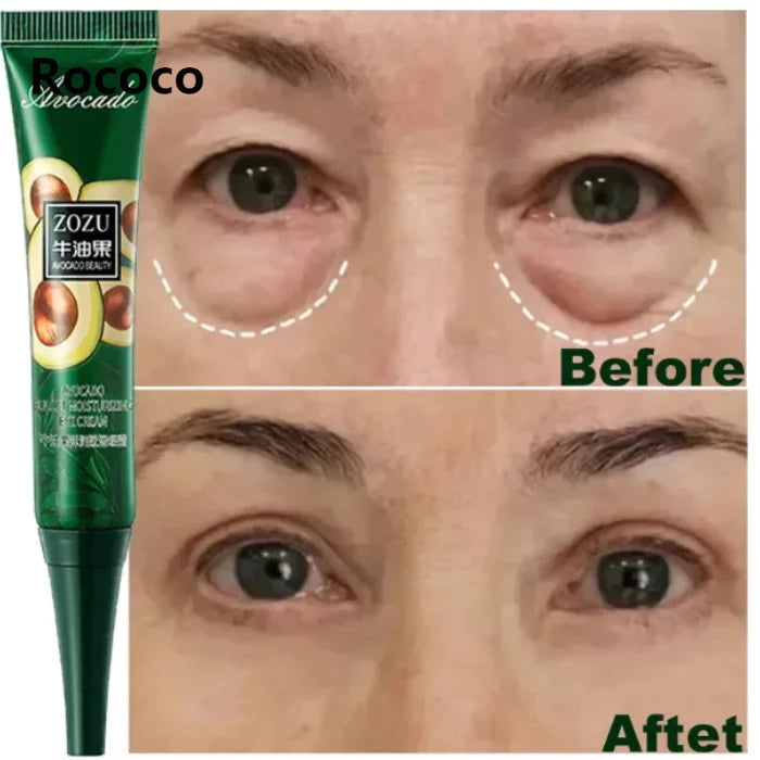 Anti Olheiras Sacos Instantâneo Remover Rugas Creme Para Os Olhos Inchaço Fade Olho Linha Fina Apertar Clarear Sob Cuida